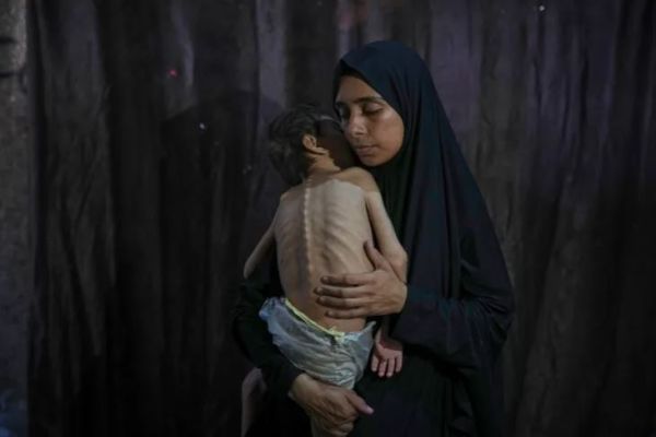 الصهيونية تعبّر عن نفسها بقتل الأطفال جوعا